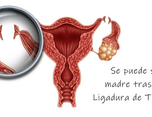 Devenir mère après une ligature des trompes est possible