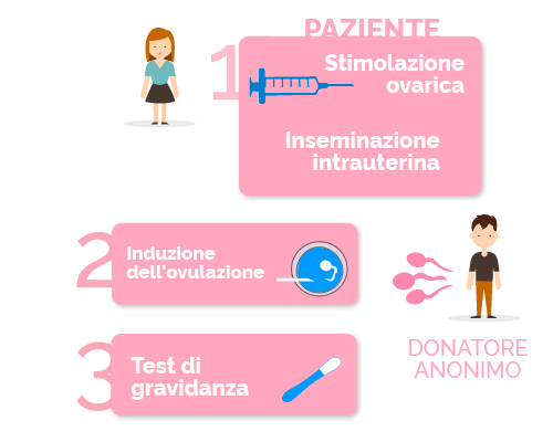 fasi dell'inseminazione artificiale con sperma di donatore anonimo