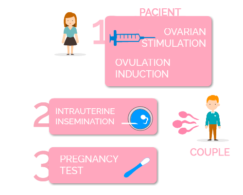 fases de la inseminación artificial con semen de la pareja