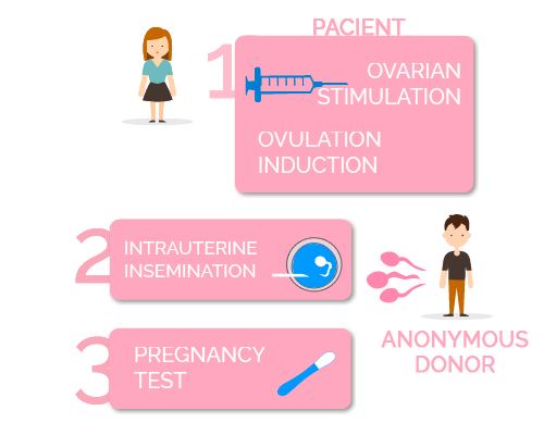 fases de la inseminación artificial con semen de donante anónimo