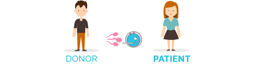 Artificial insemination with donor semen